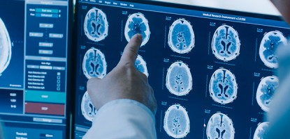 Las siete principales razones de la importancia de la radiología