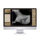 Myvet table I72W - Mesa para radiografía digital - Solucion veterinarias